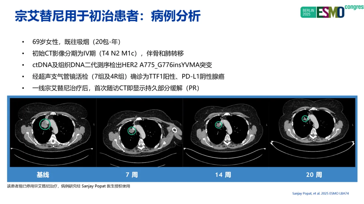 医生与患者讨论宗艾替尼耐药后的治疗方案